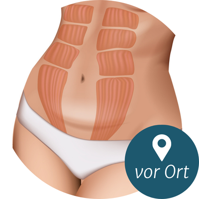 Rektusdiastase Sprechstunde